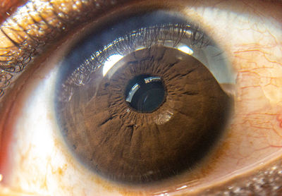 Close-up of human eye