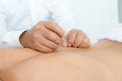 Midsection of man receiving acupuncture therapy