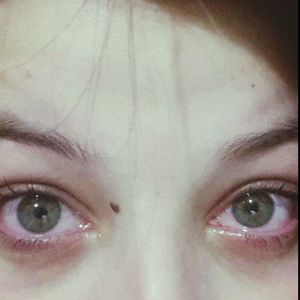 human eye