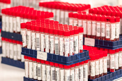 Real molecular pcr tests, nasal, oropharyngeal swabs with reagent in vials, covid-19 or coronavirus