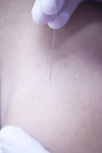 Cropped hand of acupuncturist applying acupuncture needle to woman neck