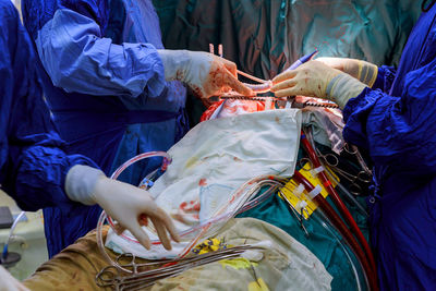 Midsection of doctors performing operation on patient in operating room