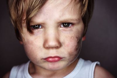 Close-up portrait of boy with wound on cheek