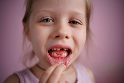 Girl smiles without a front tooth