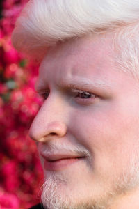 Portrait of an albino man looking away