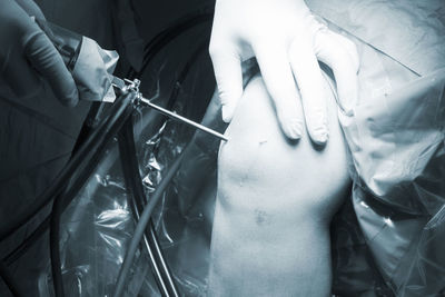 Close-up of surgeon inserting medical equipment in patient knee