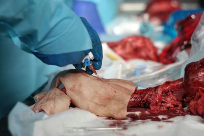 Cropped image of surgeon working in operating room