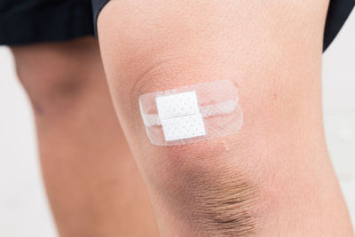 Cropped image of person with injured knee