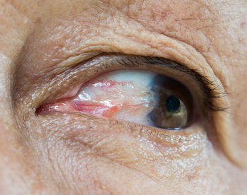 Close-up of man eye