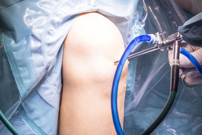 Cropped hands of doctor inserting equipment in patient knee