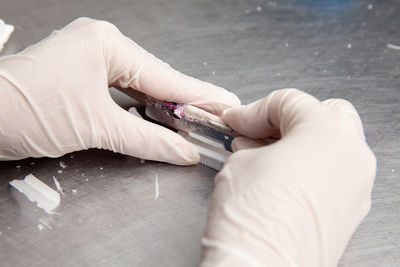 Scientist preparing paraffin blocks containing biopsy tissue for sectioning. pathology laboratory. 