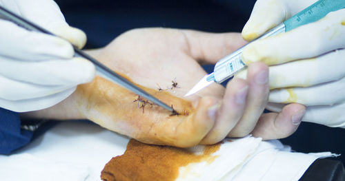 Cropped hands of doctor stitching hand