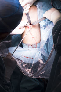 Midsection of surgeons doing knee surgery in operating room