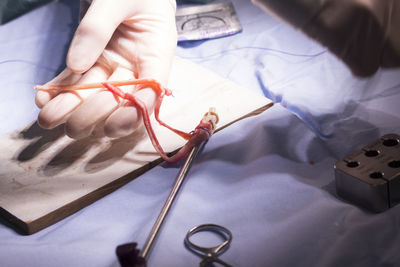 Cropped hand of doctor stitching human body part