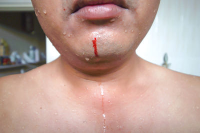 Midsection of man with injured chin