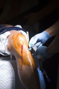 Midsection of doctor injecting syringe on patient knee in operating room