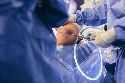 Doctors inserting endoscopy equipment while operating at operation room