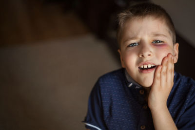 A boy with a bruised eye after a fight or violence