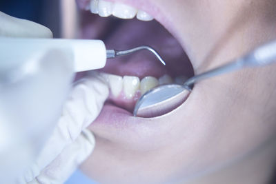 Cropped hand of doctor examining patient teeth in clinic