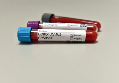 Coronavirus covid 19 infected positive result blood test sample