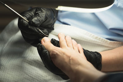 Medical pedicure close-up, tamponade ingrown toenail