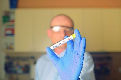 The sample of covid 19 in the test tube. doctor - epidemiologist holding thesample tube with sample