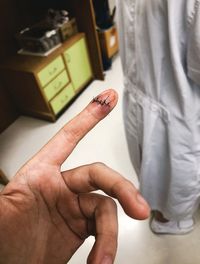 Cropped hand of patient with stitches on finger