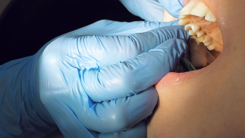 Dentist examining patient