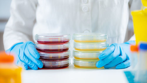 Microbiologist preparing bacterial cultures in a research laboratory, holding petri dish stacks 