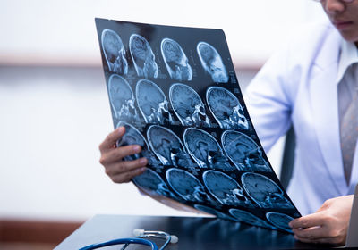 Doctor examining x-ray image in hospital