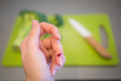 Cropped hand of woman with wound