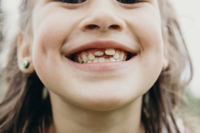 Cropped happy preschooler girl smiling widely while demonstrating growing teeth as standing against blurred green park