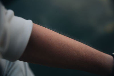 Close-up of human arm with goosebumps