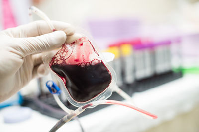 Cropped hand of doctor holding blood bag