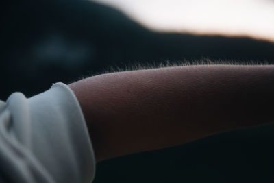 Close-up of human arm with goosebumps