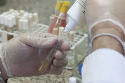 Cropped hand of doctor holding syringe