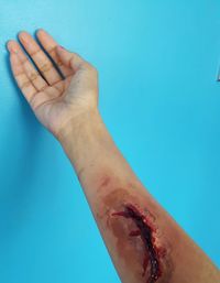 Cropped image of wounded hand on blue wall