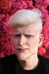Portrait of an albino man looking in the camera