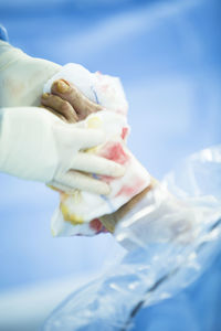 Cropped image of surgeon wrapping bandage on patient wounded foot