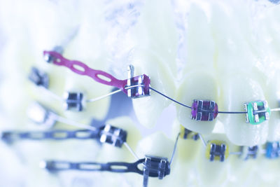 Close-up of dental equipment