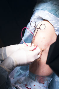 Close-up of doctor operating patient against black background