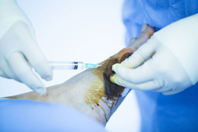 Close-up of doctor injecting syringe in patient foot in operating room