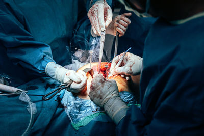 High angle view of doctors performing surgery