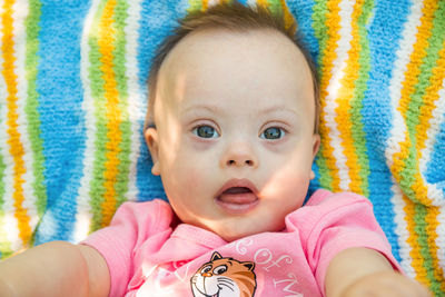 Close-up portrait of cute baby with down syndrome