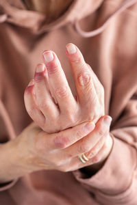 Close up of elder woman hands with atopic dermatitis, eczema, allergy reaction on dry skin