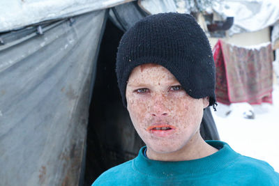 Beautiful freckles child face portrait in syrian refugee camps near the turkish border