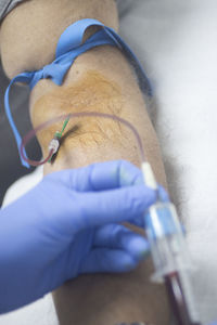 Close-up of doctor removing blood from patient arm