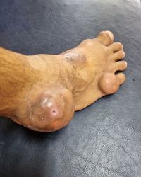 human leg