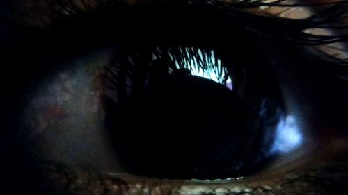 Close-up of human eye