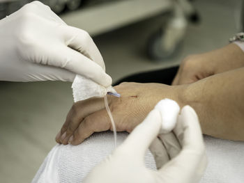 Cropped image of doctor removing medical equipment from patient hand in hospital